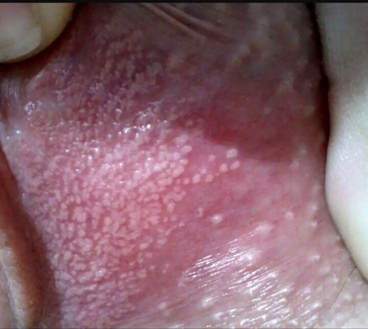 Weiss Jemand Was Diese Punkte Bedeuten Gesundheit Und Medizin Gesundheit Gynakologie Weiss Jemand Was Diese Punkte Bedeuten Gesundheit Und Medizin Gesundheit Gynakologie