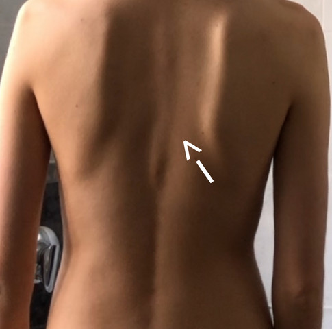 Rücken bedeutung berührung Körperkontakt: Die