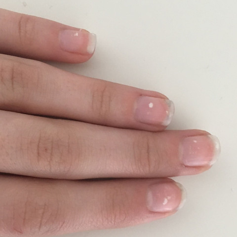 Weisse Flecken Auf Fingernageln Gesundheit Und Medizin Gesundheit Nagel Weisse Flecken Auf Fingernageln Gesundheit Und Medizin Gesundheit Nagel