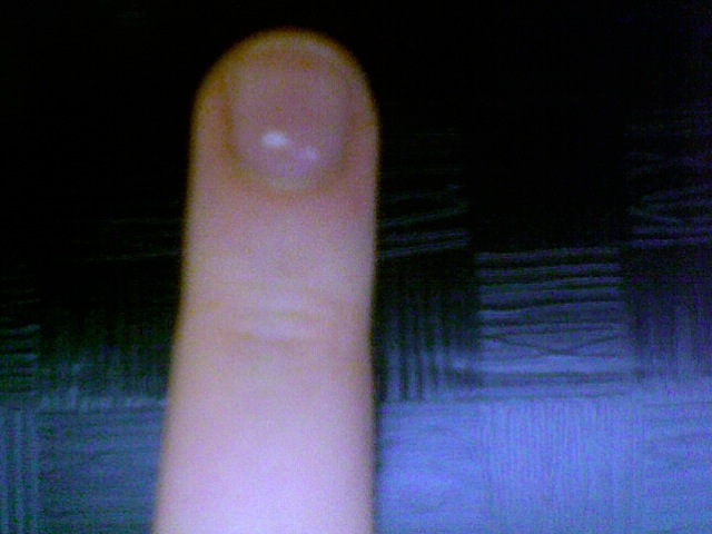 Weiße Flecken Auf Dem Nagel www.gutefrage.net