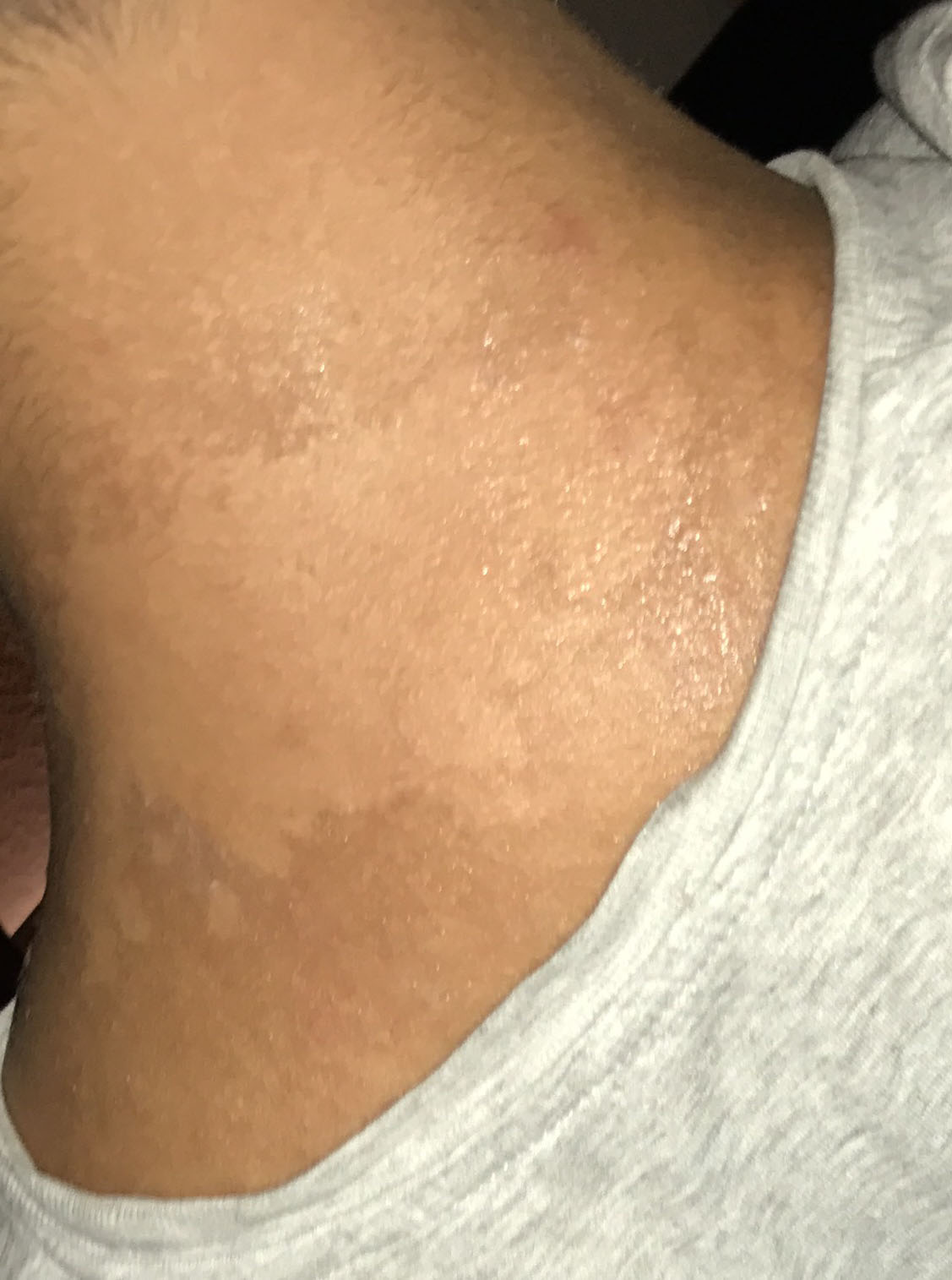 Was Bedeuten Diese Weissen Flecken Und Wie Werde Ich Sie Los Gesundheit Arzt Beauty Was Bedeuten Diese Weissen Flecken Und Wie Werde Ich Sie Los Gesundheit Arzt Beauty