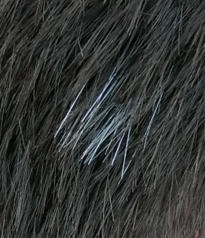 weisse haare am hinterkopf biologie