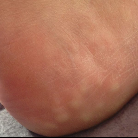 Knubbel Die Meistgelesenen Fragen Knubbel Die Meistgelesenen Fragen