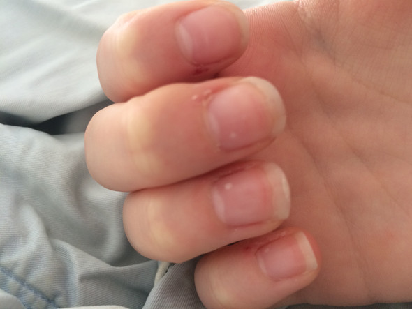 Weiße Punkte (Rechts) - (Finger, Fingernägel, weiße Punkte)