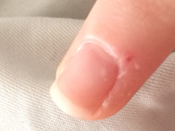 Weiße Punkte (Rechter Mittelfinger) - (Finger, Fingernägel, weiße Punkte)