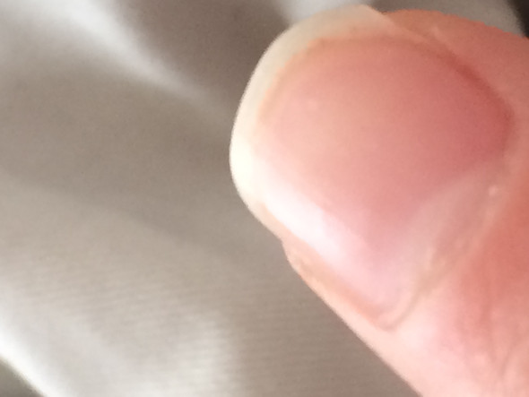 Weiße Punkte (Linker Zeigefinger) - (Finger, Fingernägel, weiße Punkte)