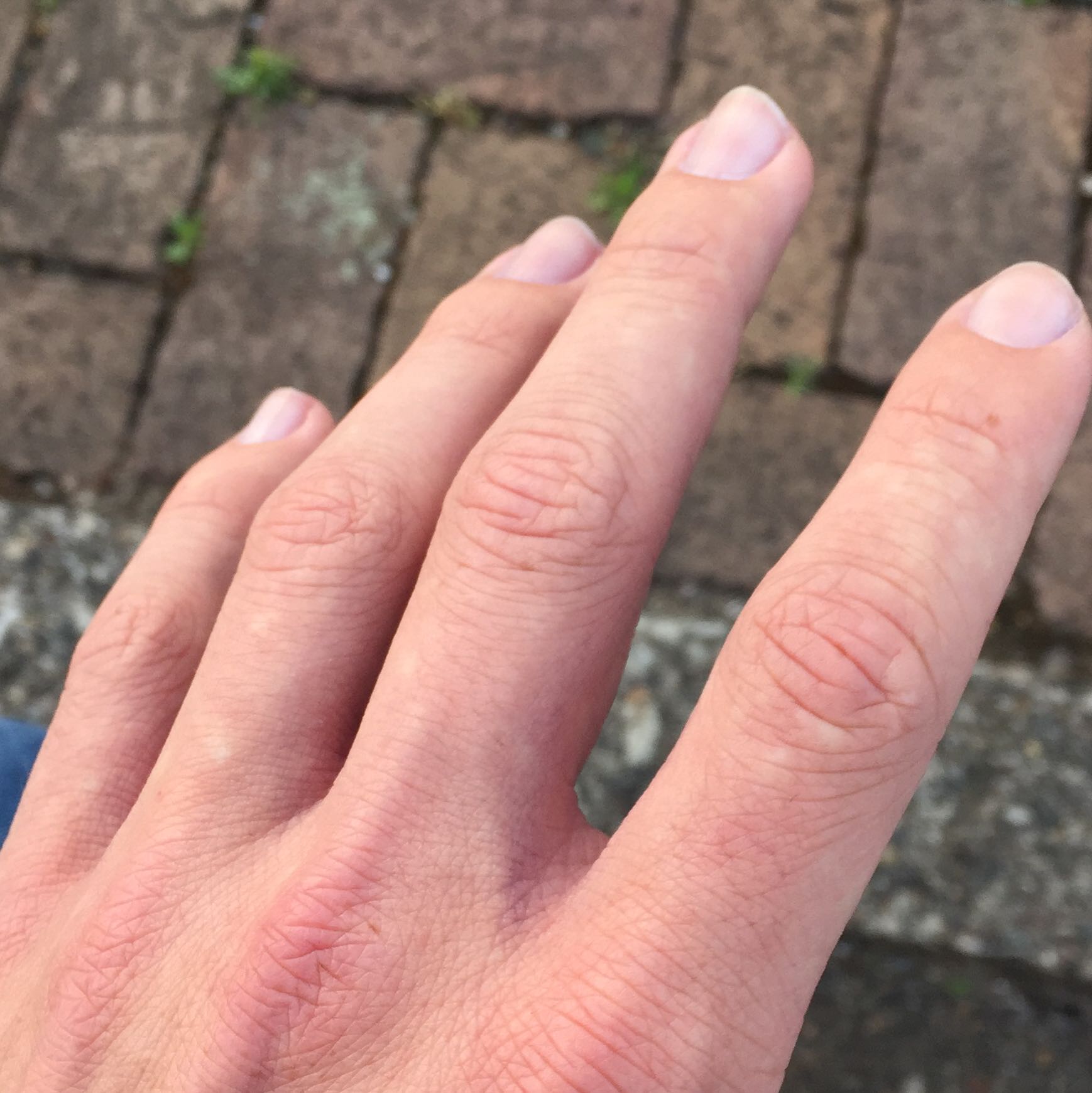 Weiße Punkte, warum? (Hand)