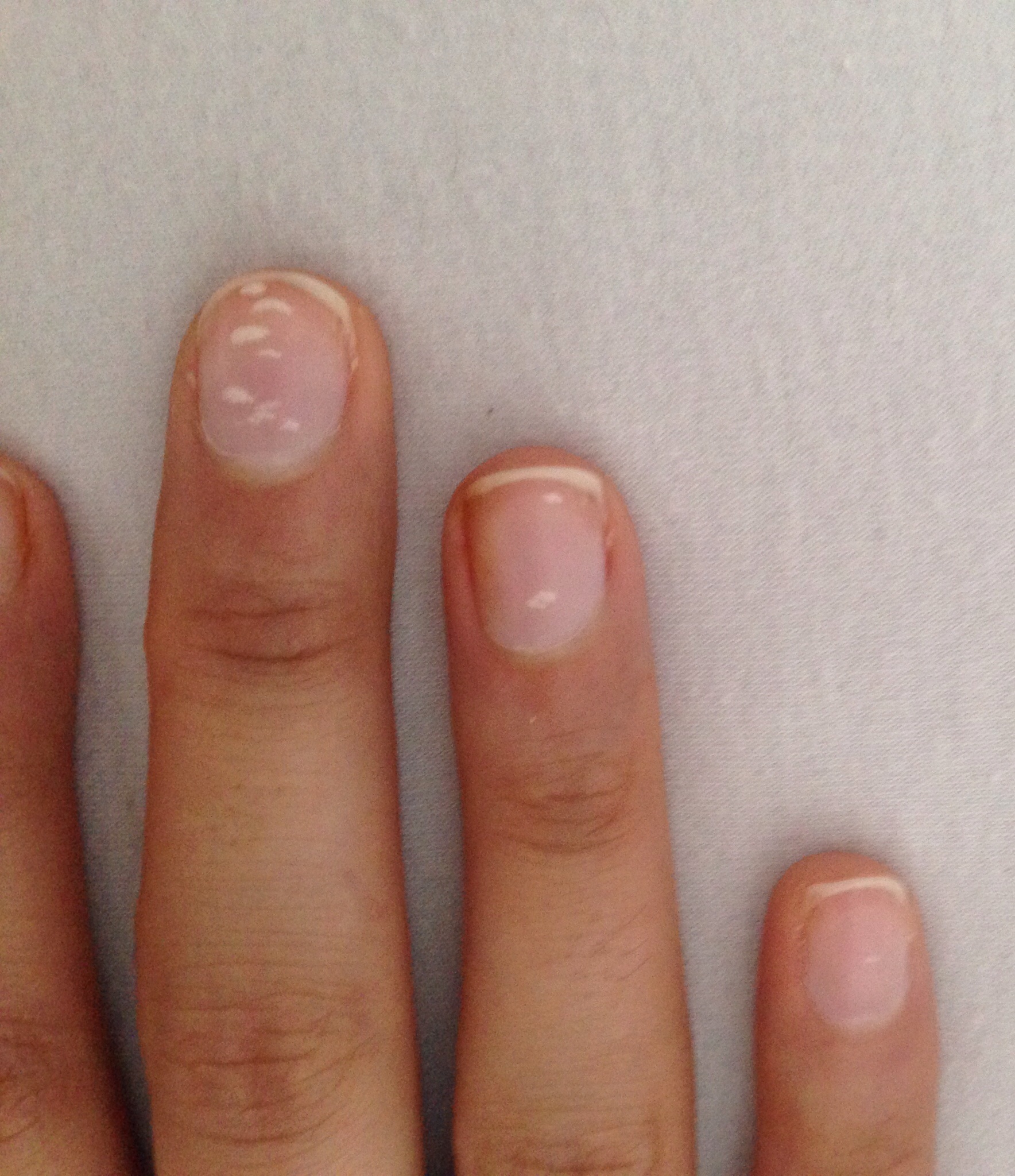 Weisse Punkte Streifen Auf Den Fingernageln Nagel Weiss Vitaminmangel Weisse Punkte Streifen Auf Den Fingernageln Nagel Weiss Vitaminmangel
