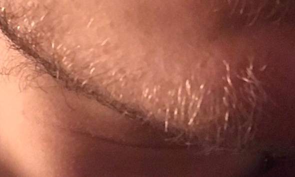 Weisse Blonde Barthaare Mit 17 Jahren Haare Bart Bartwuchs