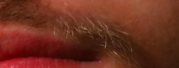 Weisse Blonde Barthaare Mit 17 Jahren Haare Bart Bartwuchs