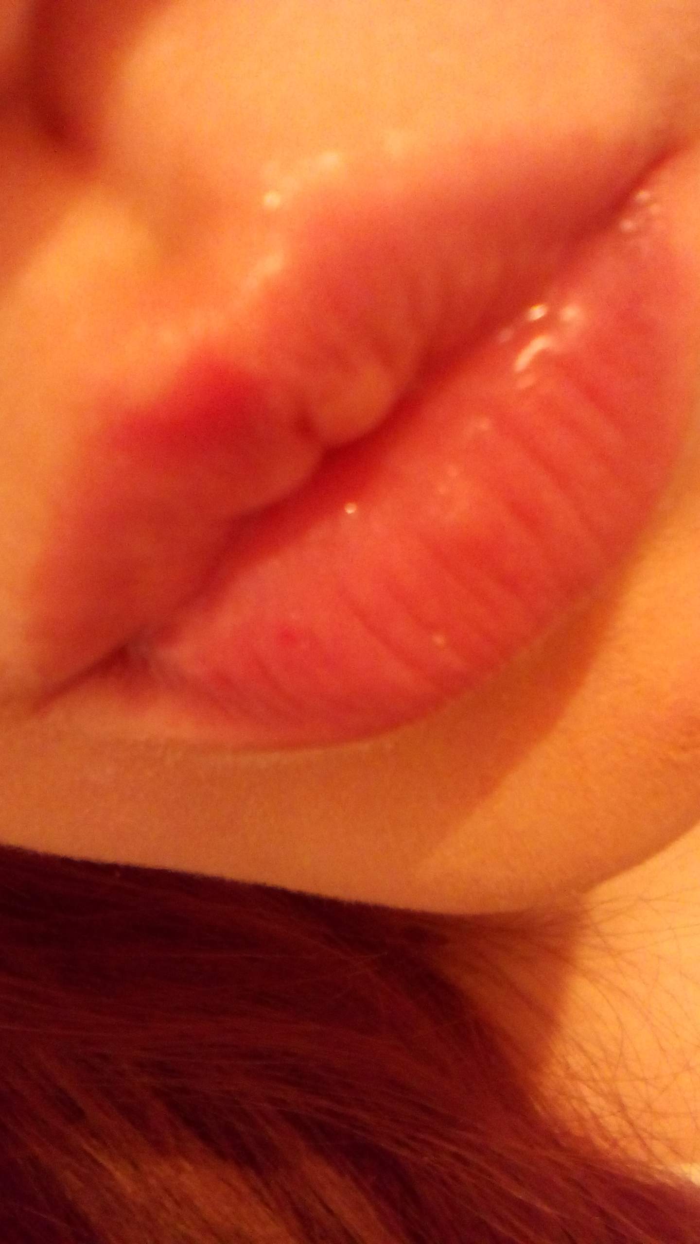 Roter rand um lippen