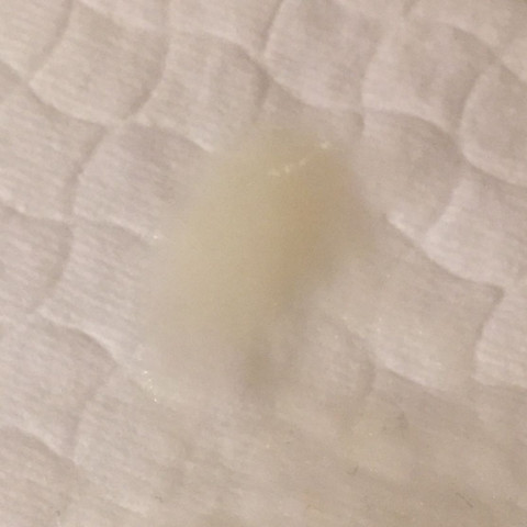 Weisser Schleim Im Intimbereich Periode Tage Unterhose Weisser Schleim Im Intimbereich Periode Tage Unterhose