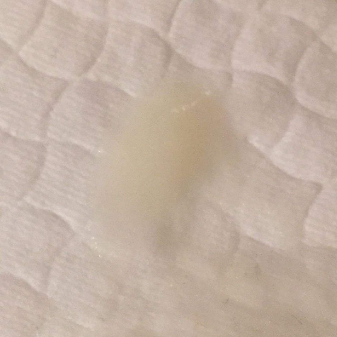 Weisser Schleim Im Intimbereich Periode Tage Unterhose Weisser Schleim Im Intimbereich Periode Tage Unterhose