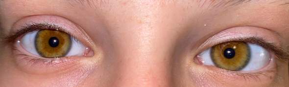 - (Körper, Augen, Aussehen)