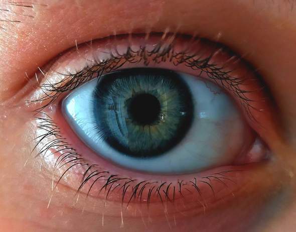 Augenfarbe die seltenste Augenfarbe