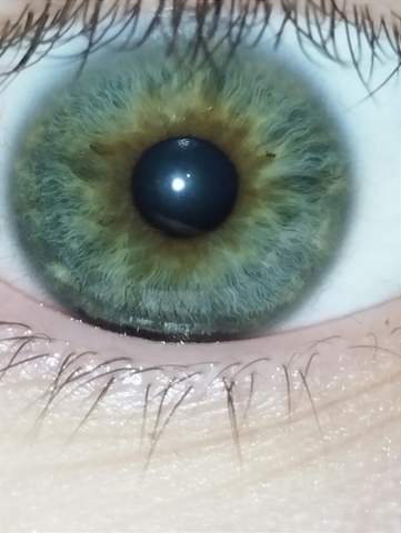  - (Augen, Augenfarbe, Augenarzt)
