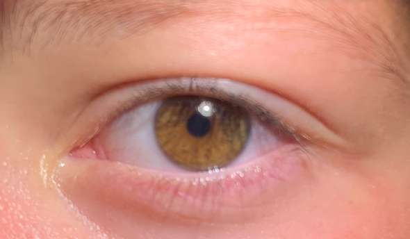 Welche Augenfarbe Habe Ich Braun Bitte Helfen Augen Farbe