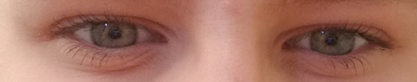 - (Augen, Augenfarbe)