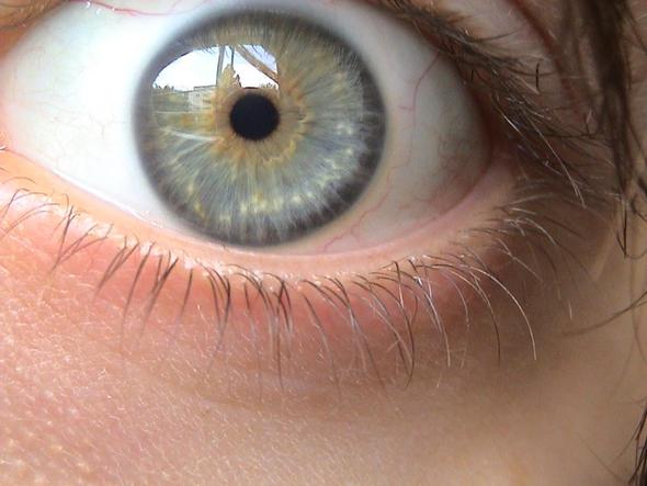 Seltenste augenfarbe die Augenfarbe: Wie