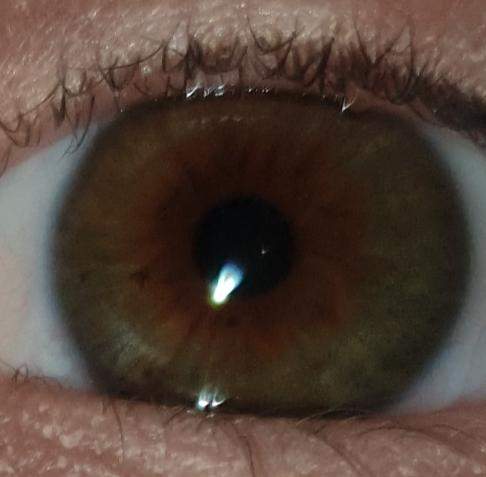- (Augen, Augenfarbe)
