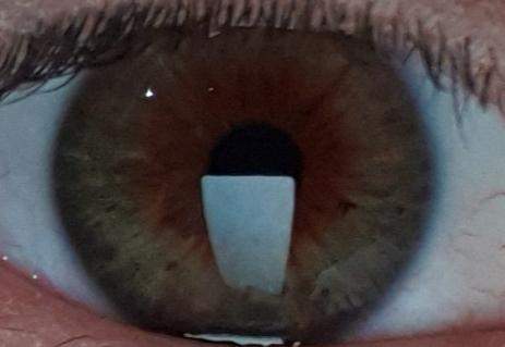 - (Augen, Augenfarbe)