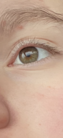 - (Gesundheit, Augen, Farbe)