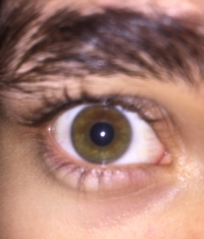 Foto - (Augen, Augenfarbe)