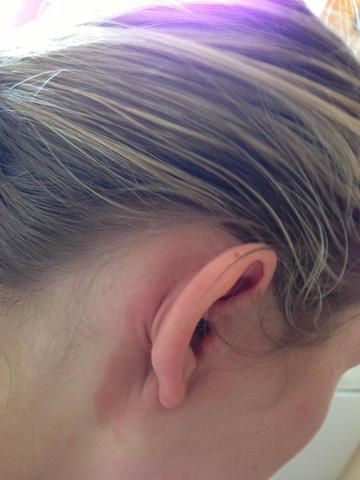 Hier ein Bild zu den Ohren - (Creme, Neurodermitis)