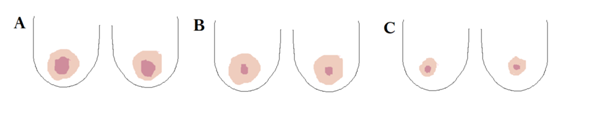 Welche dieser Damenbrüste gefällt euch am besten (schematische Zeichnung zur Verdeutlichung)?