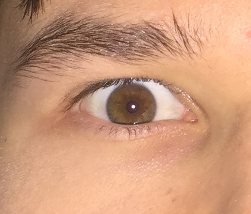 Linkes Auge - (Augen, Augenfarbe)