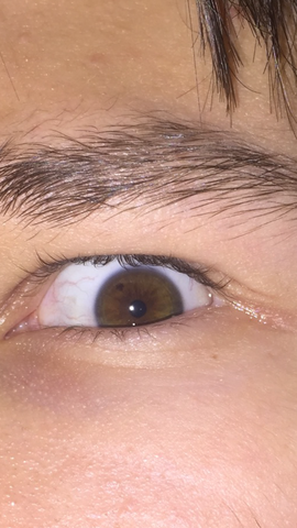 Rechtes Auge - (Augen, Augenfarbe)