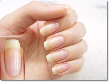 Nagelform Fur Dicke Finger