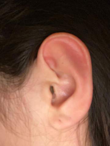Welches Helix Piercing passt zu diesem Ohr am besten?