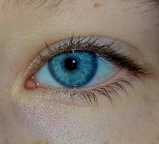 Welches meiner beiden Augen ist schöner?