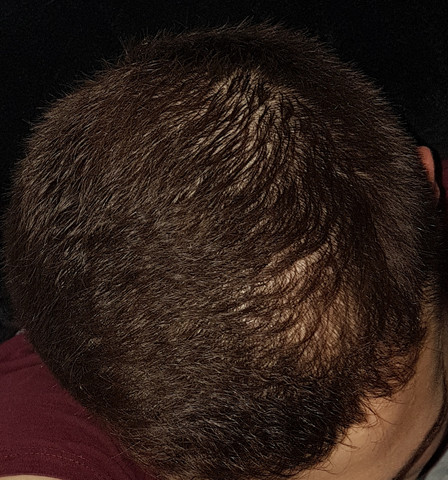 - (Gesundheit und Medizin, Männer, Harre)