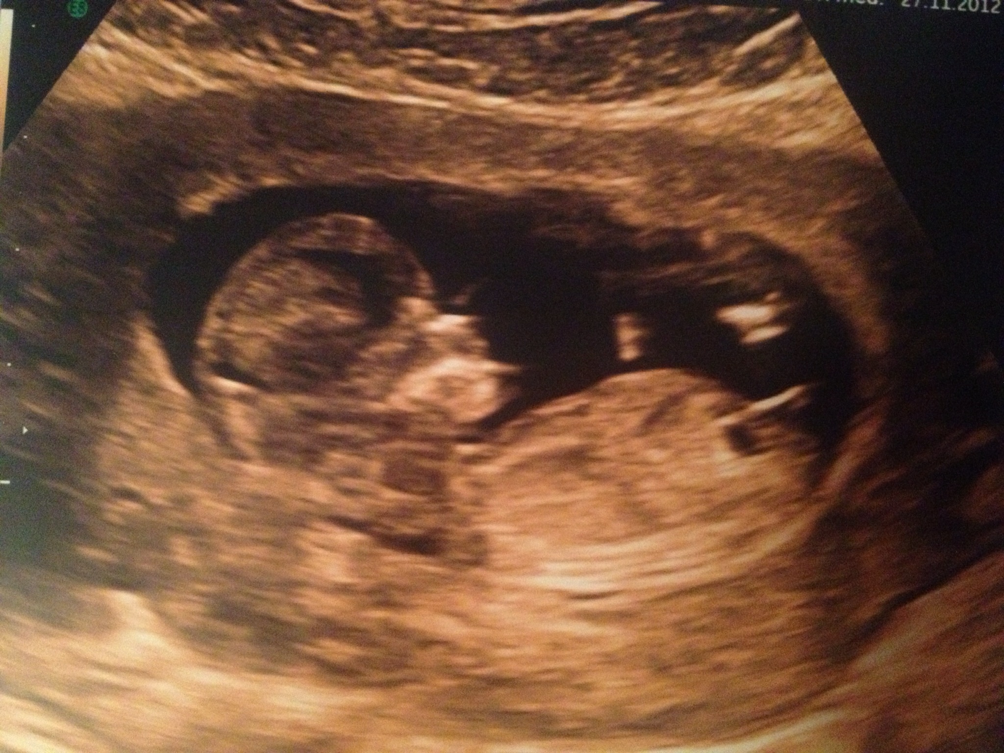 Fragen an mädchen Fragen an mädchen