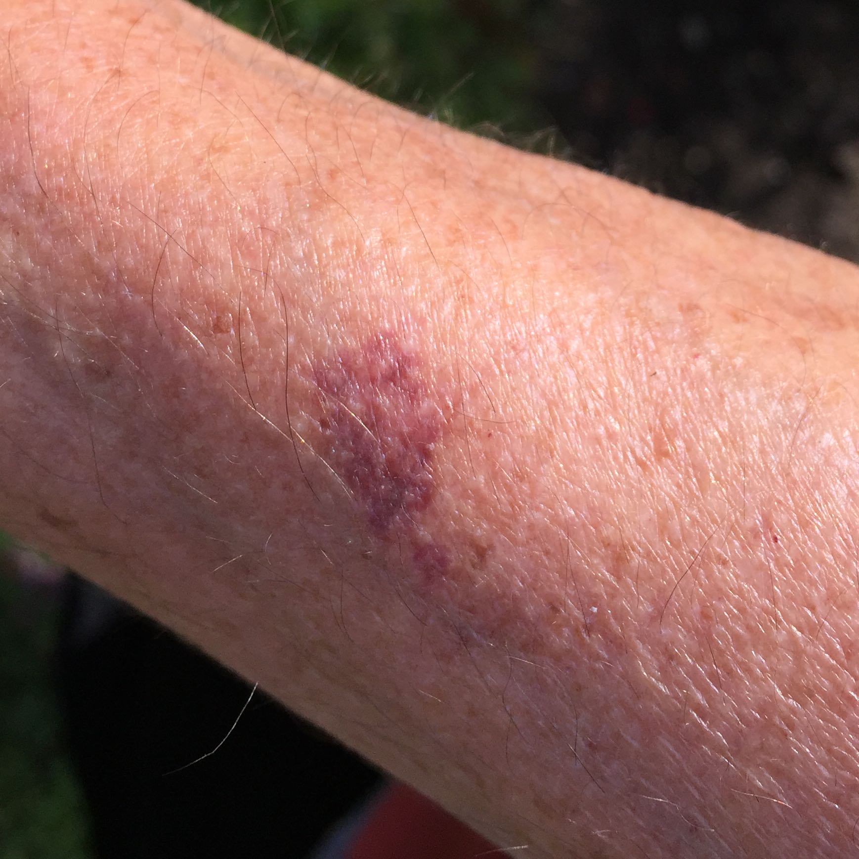 Wer kennt diese Pflanze (verursacht Ausschlag)? (Pflanzen)