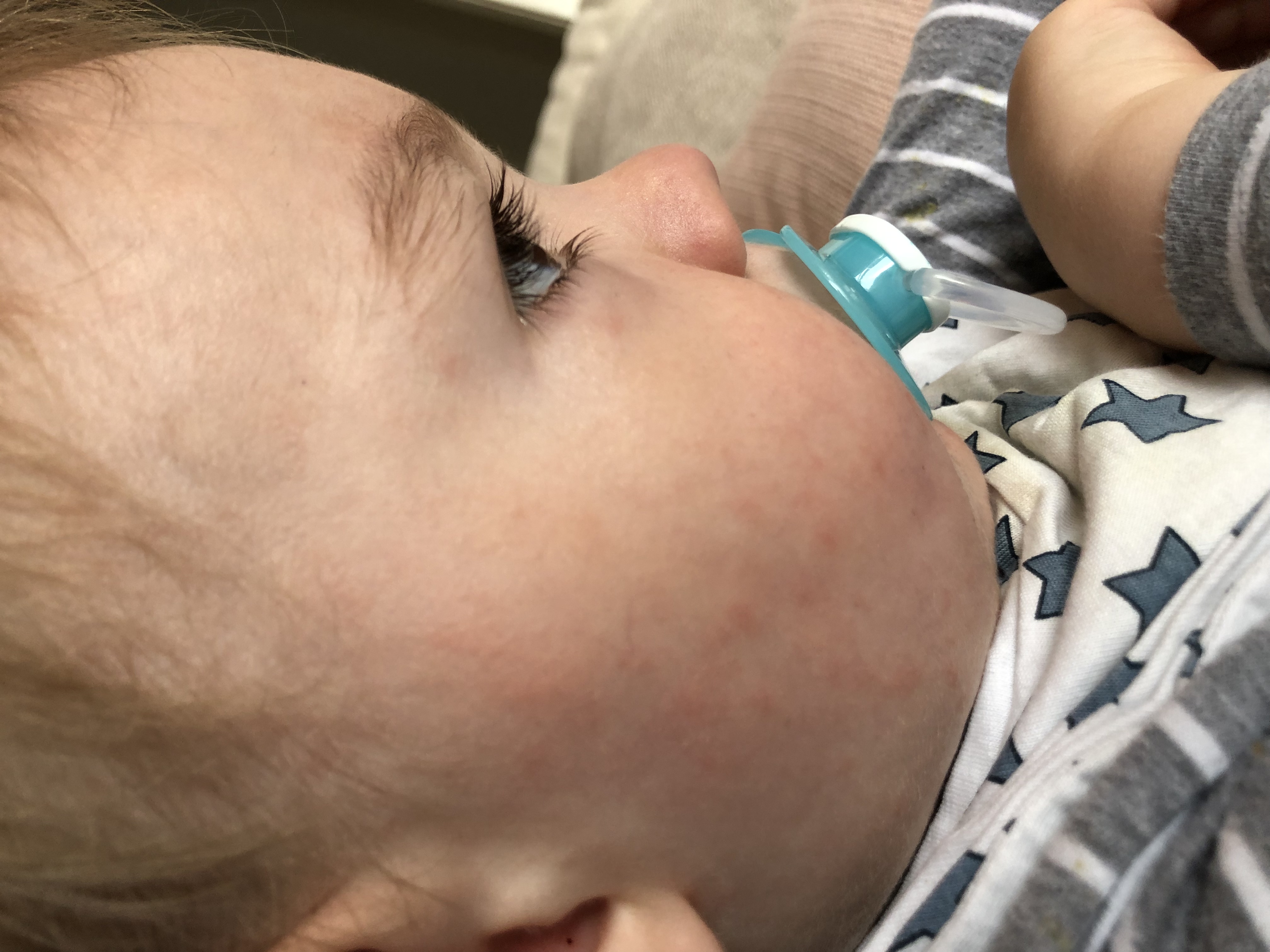 Wer weiß was diese roten Punkte bzw. Ausschlag bedeutet? (Gesundheit, Haut, Baby)