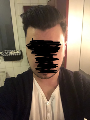Werde Ich Eine Glatze Kriegen Bild Haare Alter Frisur