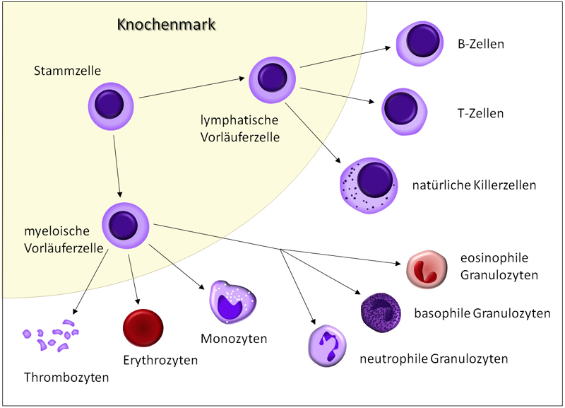 Werden Bei Leukämie (akut Myeloisch) Noch Thrombozyten Und Erythrozyten ...