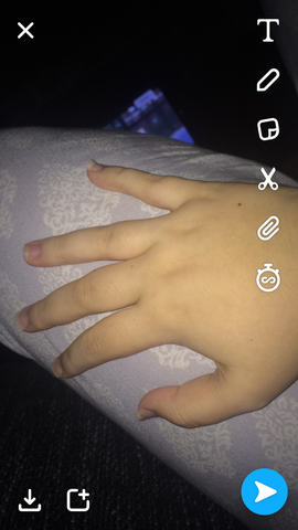 Werden Meine Finger Dunner Sobald Ich Abnehme Gesundheit Und Medizin Gesundheit Korper