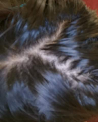 Werden Meine Haare Weniger Auf Der Kopfhaut Haarausfall Oder Ist Das Normal Das Man Die Kopfhaut So Gut Sieht Was Kann Ich Tun Das Es Dort Dichter Wird