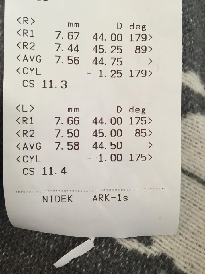 Werte vom Sehtest wo finde ich den BCWert? (Augen, Brille, Kontaktlinsen)