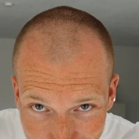 Wie Finden Die Frauen Den Glatze Mann Haare Schonheit