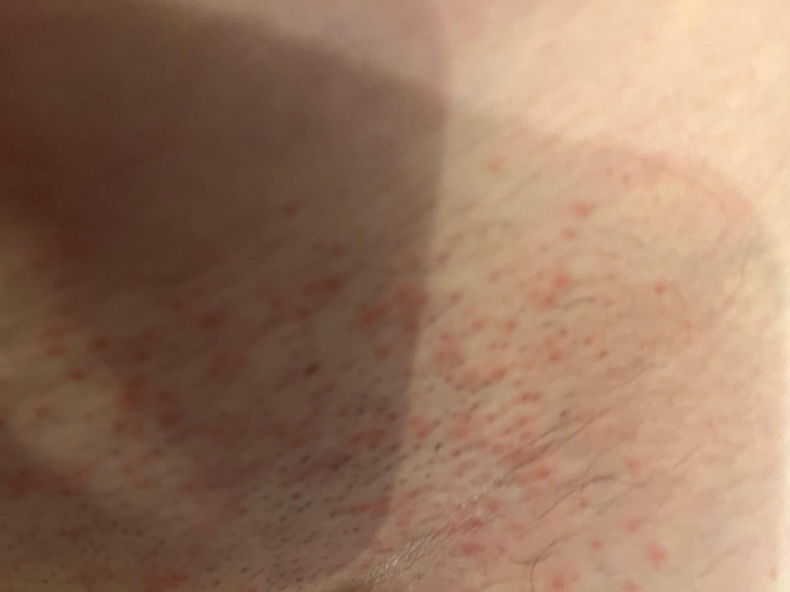 Wie beginne ich mit dem rasieren? (Männer, Körper, Hygiene)