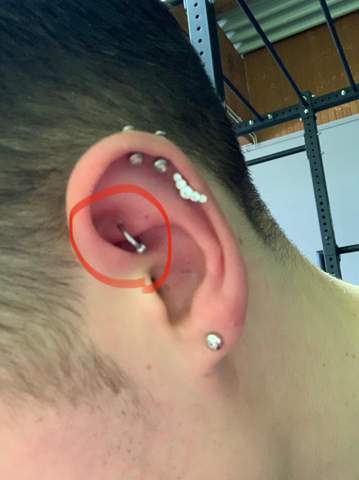 wie bekomme ich das piercing auf gesundheit und medizin piercingschmuck