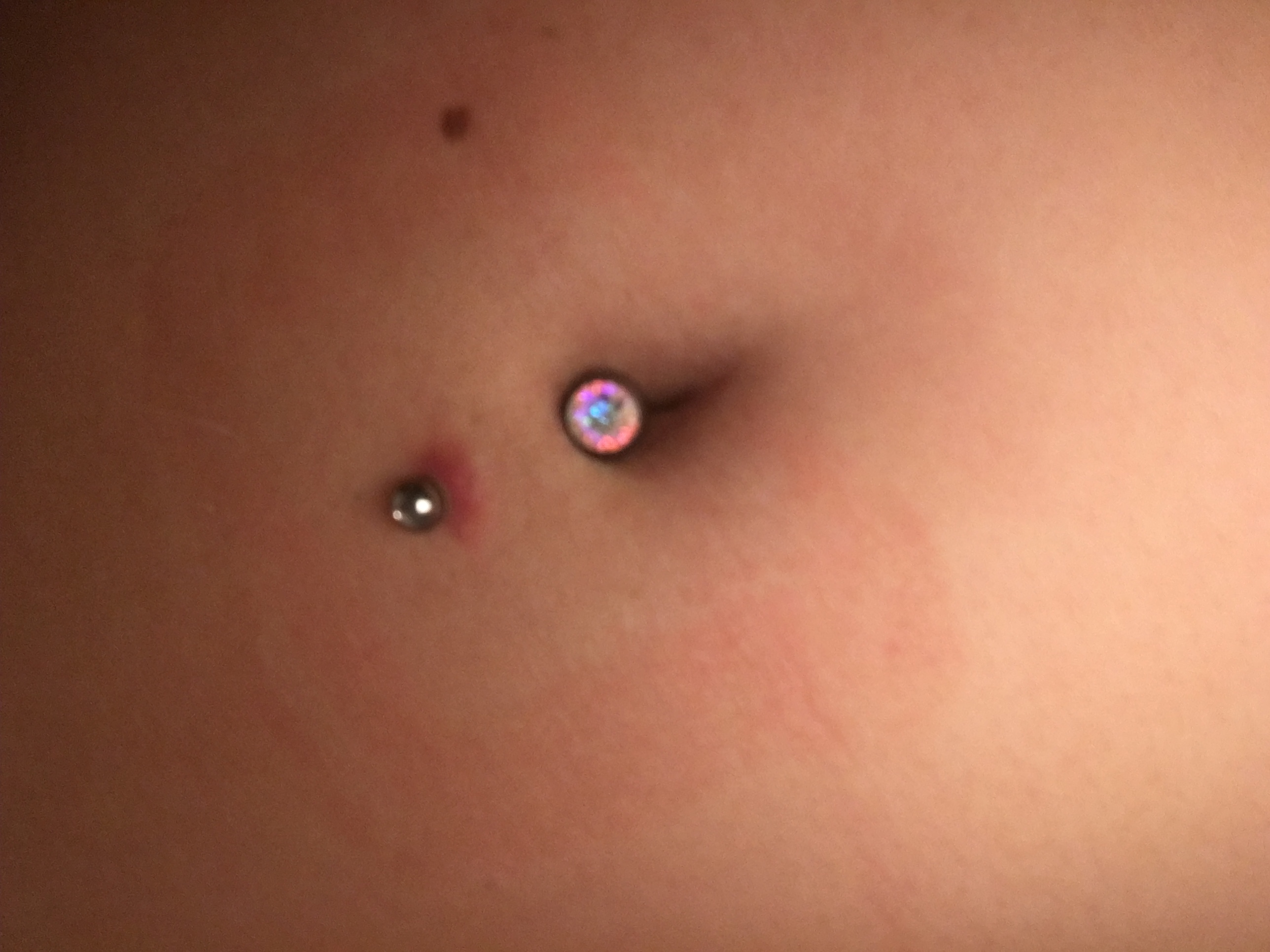 Wie Sieht Ein Entzündetes Bauchnabelpiercing Aus