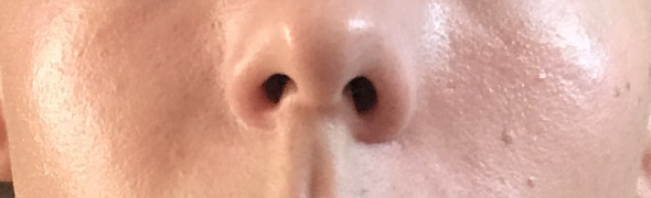 Wie bekomme ich diese falten bzw nasolabialfalten weg? (Gesicht)