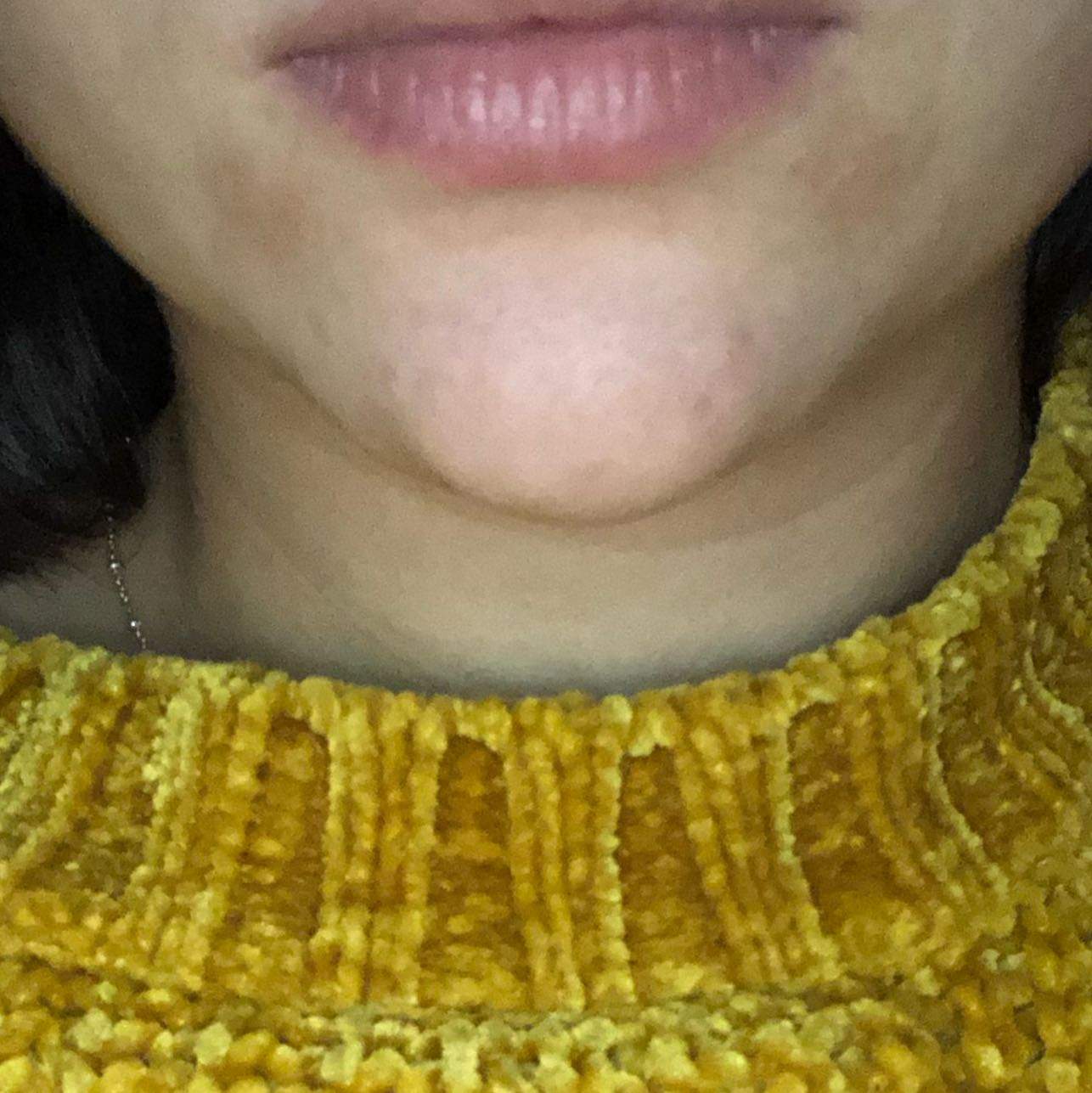 Wie Bekomme Ich Diese Trockene Haut An Meinem Mund Weg Gesundheit Und Medizin Kosmetik Wie Bekomme Ich Diese Trockene Haut An Meinem Mund Weg Gesundheit Und Medizin Kosmetik