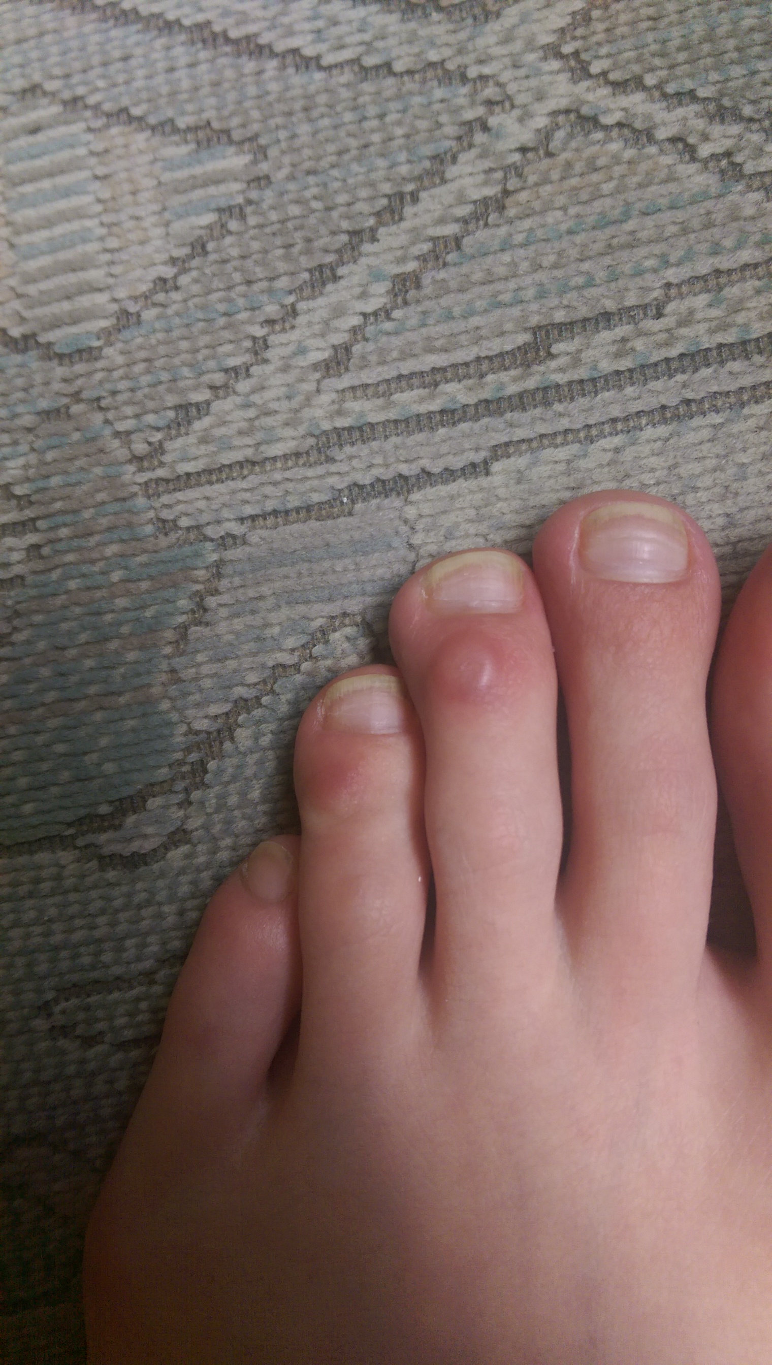 Wie bekomme ich diese